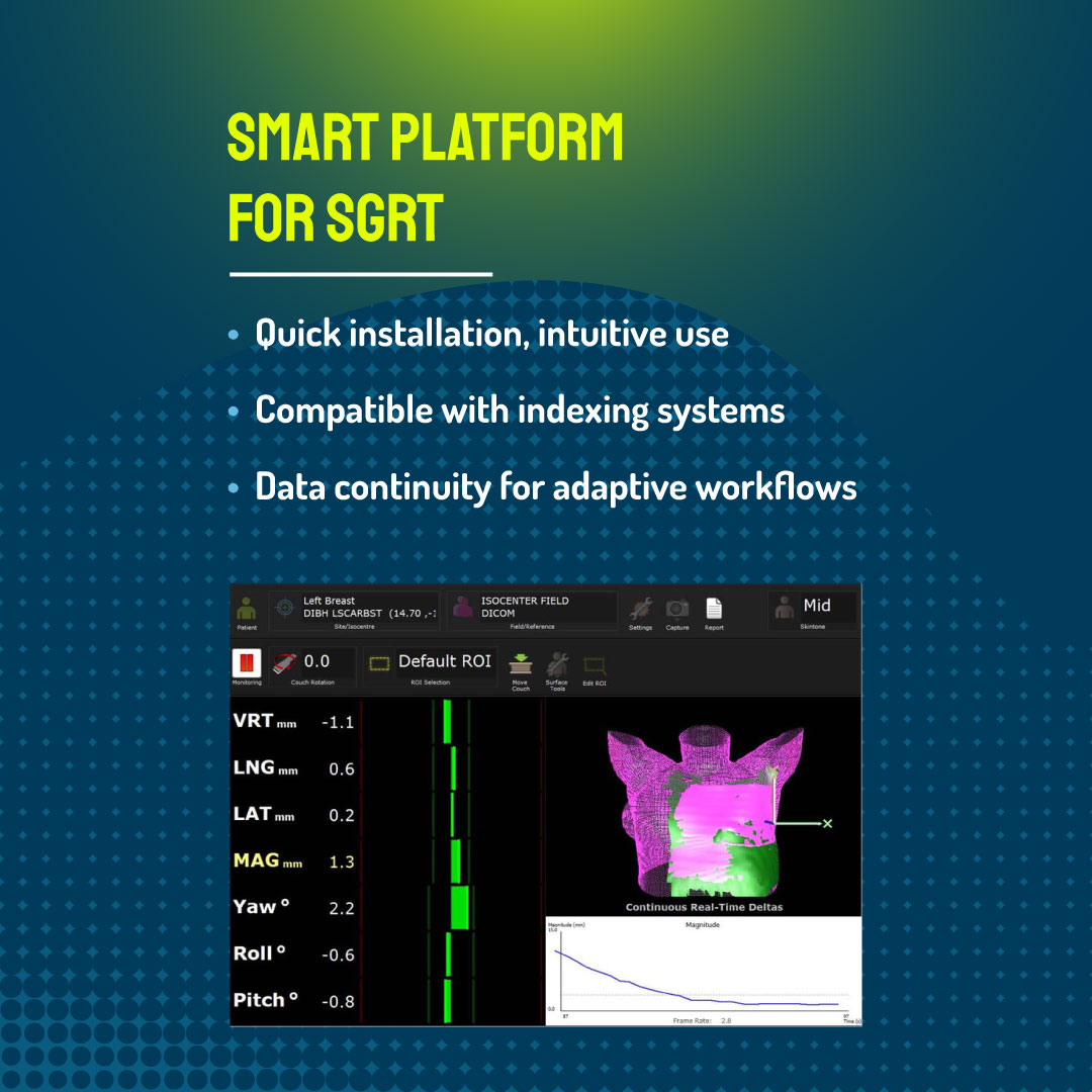 RPS-SGRT_post_slide5